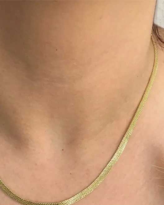 A woven gold chain worn at the neck.